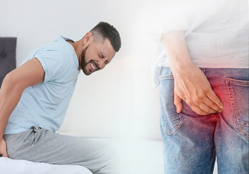 Cách chữa bệnh trĩ lâu năm hiệu quả, ngăn ngừa bệnh tái lại